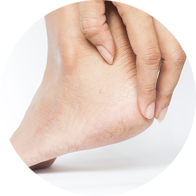 Close-up of foot nurse examining patient's heel.