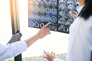 Doctors Looking And Pointing At Brain Scans, Discussing.